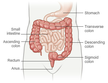 ulcerative-colitus-abdomen-1
